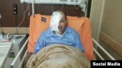 علیرضا رجایی، روزنامه‌نگار و از فعالان ملی – مذهبی، پس از عمل جراحی، چشم راست و بخشی از ماهیچه و استخوان‌های سمت راست صورتش را از دست داده است.