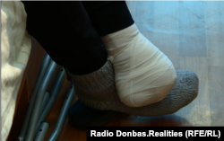 Обморожену ступню Володимира лікарям не вдалося врятувати