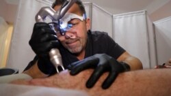 Ukrainian Rehabilitation Program Treats War Burns And Scars For Free