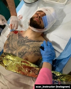 Дмитро отримав кульове поранення в голову