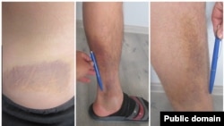 №8 түзөтүү колониясында сабалган делген адамдардын денеси. Сүрөт Кыйноолорду алдын алуу боюнча улуттук борбордуку.