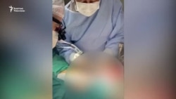 Бишкекте боор алмаштыруу операциясы жасала баштады
