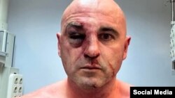 Голова партії «Єдиний національний рух» Леван Хабеїшвілі (на фото) перебуває в тбіліській клініці Інгороква