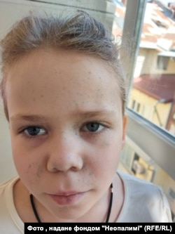 Ангеліна до проведення процедури