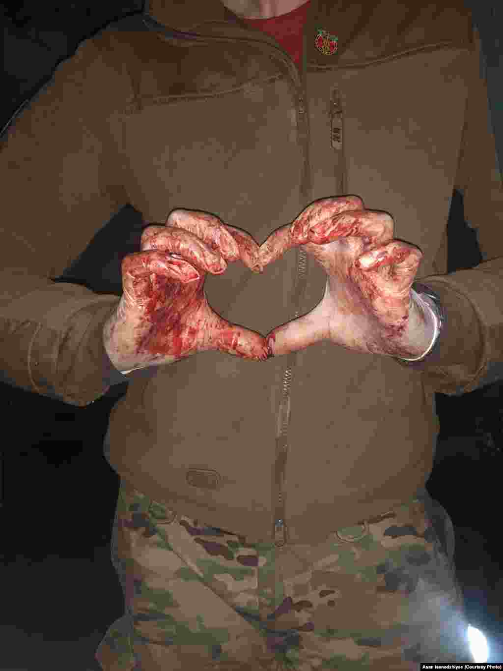 Bu fotoresimde Azovstalde Asan İsenacıyevniñ qanlı elleri körüne. Asan, fotoresimni Instagramda derc etip, şunı yazğan edi: &quot;Anama şunı aytıñız ki, men çoq acılar kördim, amma iç bir vaqıt yıqılmam&quot;. 83 kün mudafaa ve 227 kün esirlikte bulunıp, qırımlı arbiy hızmetini bitirdi. Şimdi esas Ukrayinada birinci tibbiy yardım kösterüv kurslarını keçire. Qırımğa qaytmaqnı arzu ete