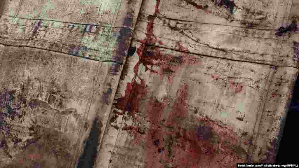 &hellip;і запечена кров на них