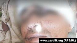 Жамшид Бобоёров калтакланиши ортидан ҳушсиз аҳволда касалхонага ётқизилган.