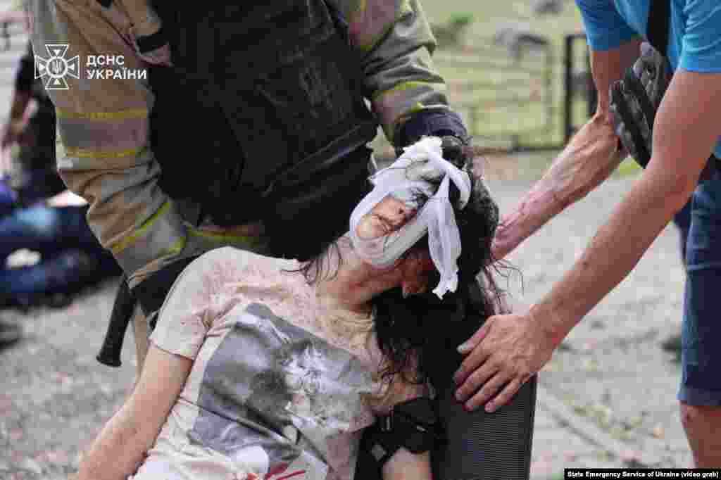 امدادگران به یکی از ده‌ها غیرنظامی آسیب‌دیده در اثر انفجار بمب‌های هدایت‌شونده‌‌ که روسیه بر خارکیف انداخته بود، کمک می‌کنند