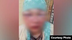  Күйөөсү аёосуз сабаган келин. (Сүрөттөр Айзаттын макулдугу менен жарыяланды)