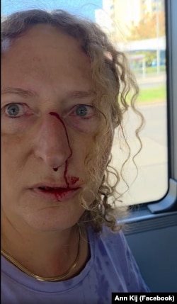 Зенобія Жачек після інциденту