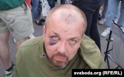 Вязень, якога вызвалілі з турмы на Акрэсьціна ў Менску, 2020