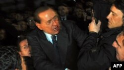 سیلویو برلوسکونی دقایقی پس از حمله به وی