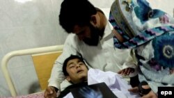 Талибандын кол салуусунан 126 адамдын өмүрү кыйылды. Сүрөттө: жаракат алган бала ооруканада жатат. Пакистан. 16-декабрь, 2014