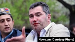 Фотография - News.am