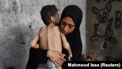 Սովը Գազայում աղետալի մակարդակի է հասել, երեխաների մեծամասնությունը թերսնված է. լուսանկարն արվել է հուլիսի 24-ին, 2025թ. 