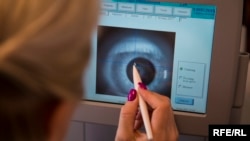 Так виглядає око крізь спеціальний апарат. 16 травня 2017 року