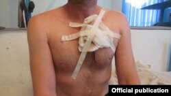 Кыйноолорду алдын алуу боюнча Улуттук борбор тараткан сүрөт.