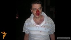 Ակտիվիստը չի ճանաչել իրեն ծեծելու մեջ կասկածվողներին