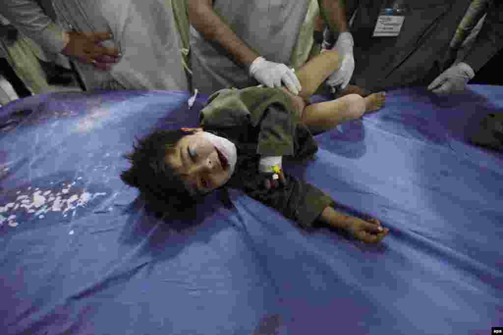A child receives medical treatment at a hospital in Peshawar.