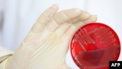 Бактерія Е.coli