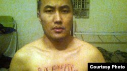 Гүлжаһан Нуриддинованың айтуынша, түрмеде денесін тіліп тастаған сотталушы Қанат Орынбеков.