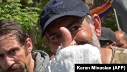 Нікол Пашинян з пораненою під час протестів рукою.