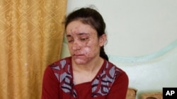 Девушка-езидка, спасенная из рабства у боевиков