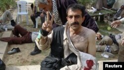 یکی از مجروحان درگیری در اردوگاه اشرف