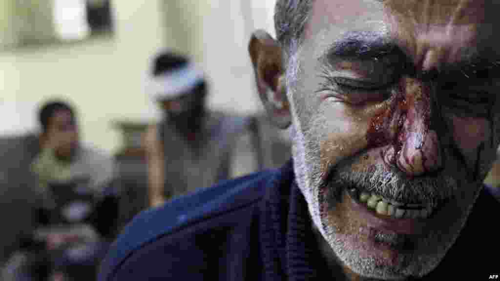 کمال، دختر هشت ساله&zwnj;اش را در همان روزهای اول جنگ حلب از دست داد؛ هیچ یک از تلاش&zwnj;های بین&zwnj;المللی به آتش&zwnj;بسی پایدار در سوریه نیانجامیده است.