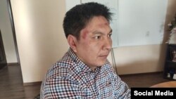Bolot Temirov was attacked near his website's office in Bishkek in January 2020.