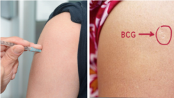 ​БЦЖ-вакцинаны коюу.