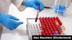 Бишкектеги лабораториялардын бири, 2018-жыл.