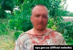 Побитий охоронець