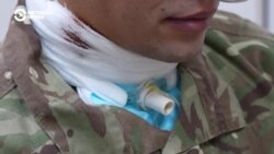 История украинского военного, пережившего пытки в российском плену