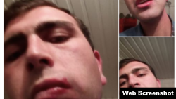 Гражданский активист Вагинак Шушанян разместил свое фото со следами травмы в Facebook, 20 декабря 2014 г.