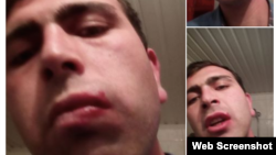 Гражданский активист Вагинак Шушанян разместил свое фото со следами травмы в Facebook, 20 декабря 2014 г. 