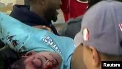 یکی از قربانیان خشونت‌ها در بنغازی.