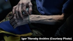 Рукі вызваленага з палону ўкраінскага вайскоўца. Архіўнае фота