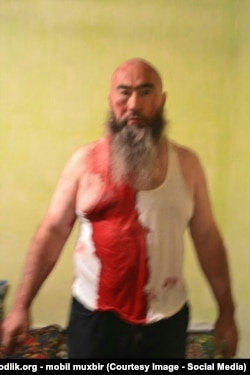 Dilyar Jumabaev after his beating, allegedly by security forces