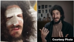 ფოტოკოლაჟი: ზვიად მაისაშვილი მასზე ძალადობიდან რამდენიმე საათში და BBC-ს მასალაში