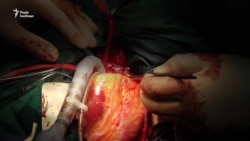 Яка ціна нерозвиненої трансплантології в Україні? (відео)