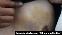 Барымтага алынган кыргызстандык.