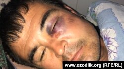 35-летний фермер Кахрамон Темиров утверждает, что сотрудники сурхандарьинской прокуратуры избили его и сломали ему ребро. 