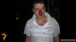 Չնայած ծեծին՝ Երևանի քաղաքապետարանի մոտ նստացույց անողները վճռական են