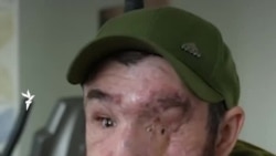 «Я рад, что жив. А то, что не вижу в жизни... Я уже многое увидел». История украинского бойца