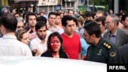 در جریان اجرای طرح امنیت اجتماعی بارها موارد از برخورد خشونت بار پلیس در رسانه ها بازتاب یافت.