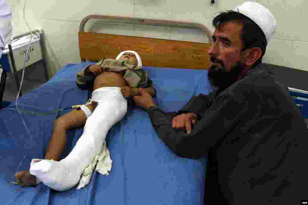 A boy receives medical treatment at a hospital in Jalalabad, Afghanistan.