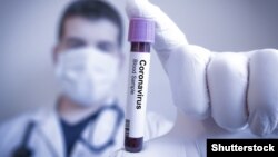 Тест на выявление коронавируса. Иллюстративное фото.  