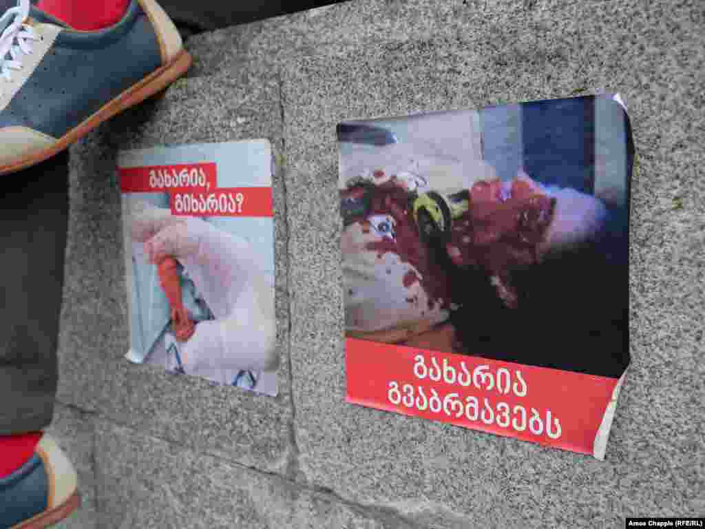 Плакати перед будівлею парламенту в Тбілісі. Протестувальники зазначають, що зображення праворуч показує демонстранта, якому ввечері 20 червня влучила в око гумова куля &nbsp;