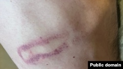 Լուսանկարը՝ դիտորդական խմբի